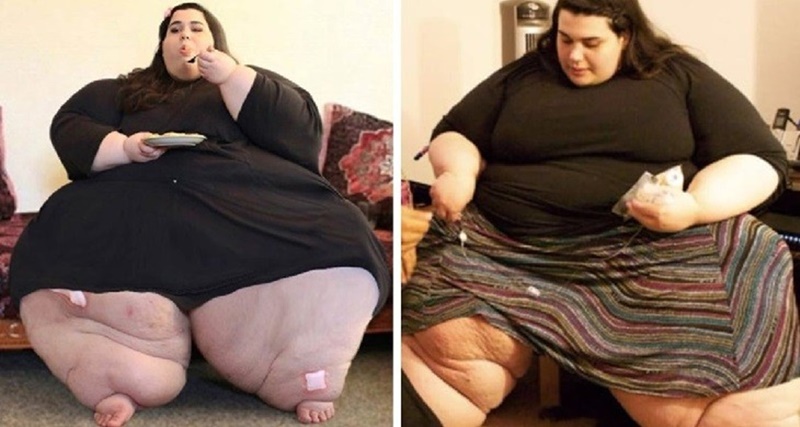 Jovem obesa de 25 anos perde mais de 180kg e fica lindíssima; fotos impressionam