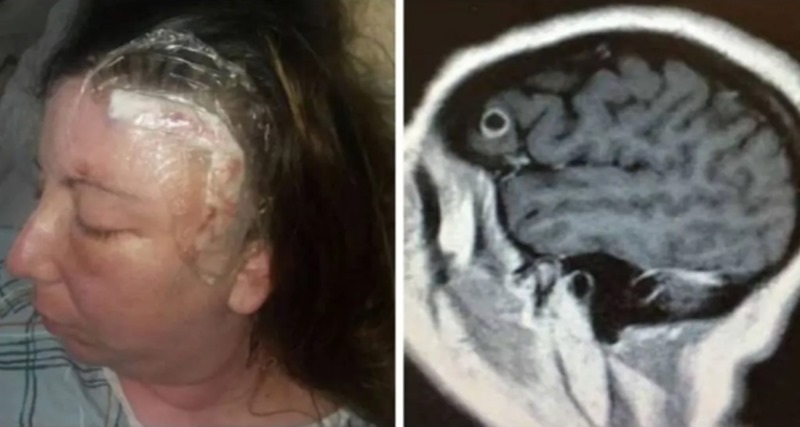 Mulher vai ao médico reclamando de dores na cabeça, mas o que tinha no seu corpo era ASSUSTADOR.