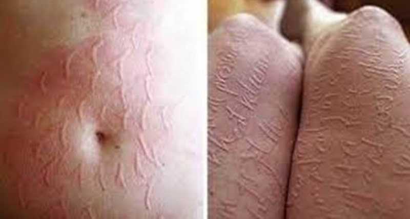 Mulher marca encontro com homem casado e apanha de chicote da esposa dele, veja o vídeo