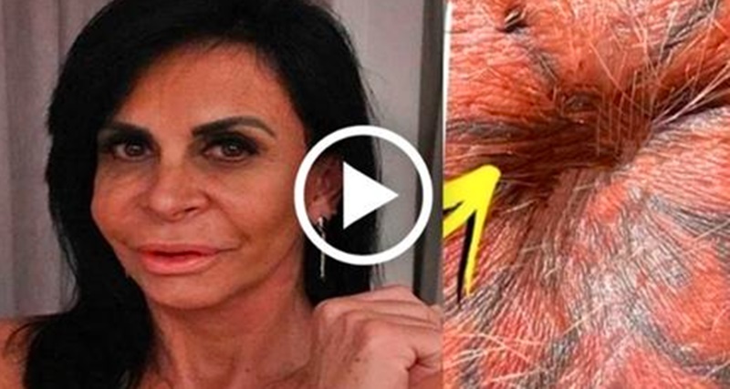 Gretchen posta foto bem estranha da parte do seu corpo e todos ficaram confusos ‘é o close dele’