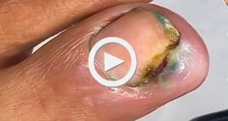 Olha o que vai sair da unha, meu Deus – VEJA