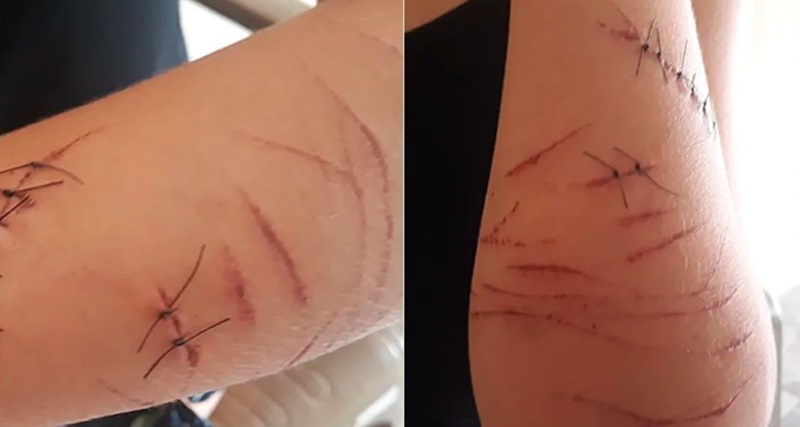 Mulher com mal cheiro nas partes íntim4s é atacada por urubus durante relação com namorado no mato