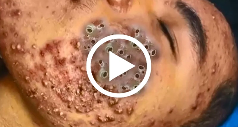 Não acredito no que saiu de dentro disso um enor… ver mais