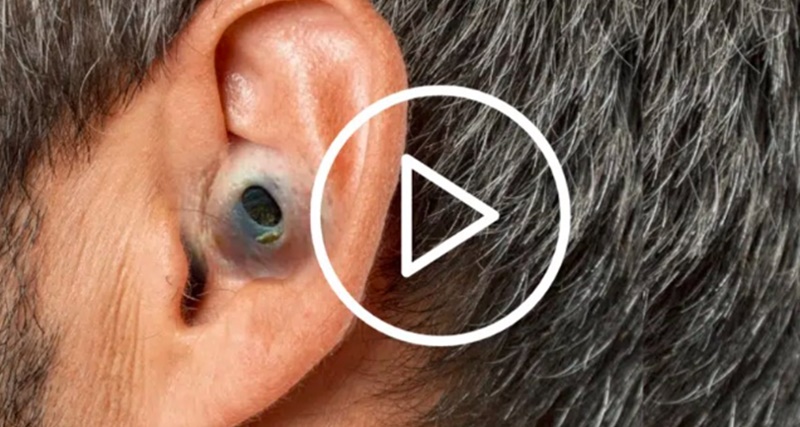 Olha quantos bichos tinha lá dentro disso – VÍDEO