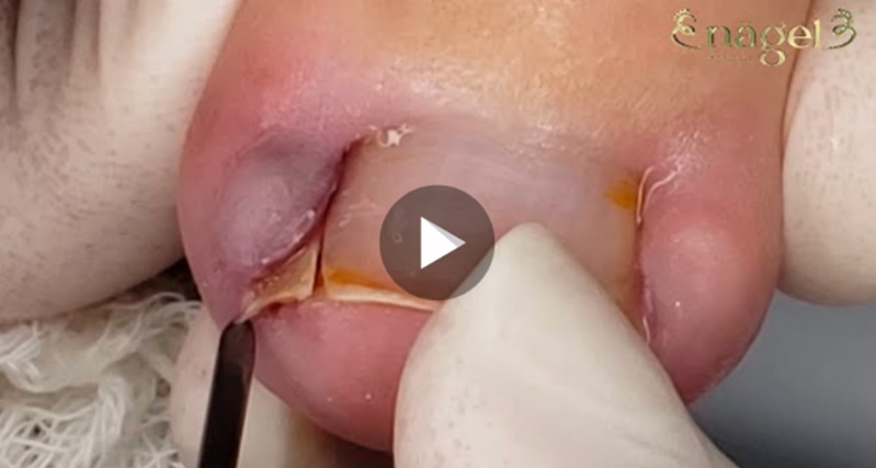 Olhem o que vai sair de dentro disso, MEU DEUS!!