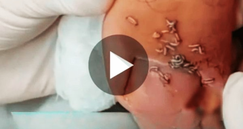 MEU DEUS! Você Não Vai Acreditar No Que Saiu Ali De Dentro; ‘Quase Não Acreditei No Tanto De Lar… Ver Mais2