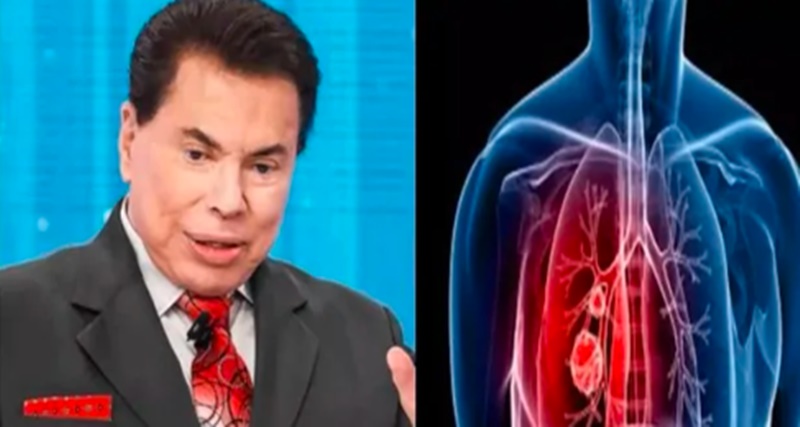 ALERTA! Esses são os sintomas da doença que levou SILVIO SANTOS a m0rte; Muito cuidado com… Ver mais