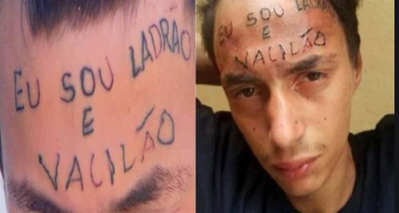 Lembra do rapaz que teve a testa tatuada ‘ladrão e vacilão’? Como ele está atualmente vai te deixar chocado