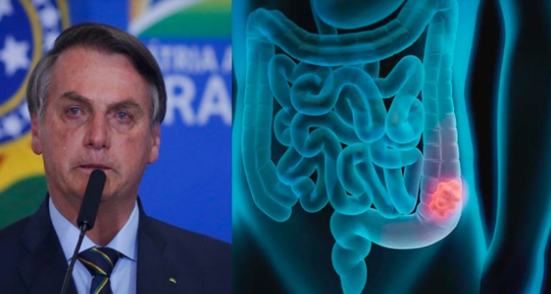 URGENTE: Após ser internado as pressas, chega triste notícia sobre Bolsonaro, ele p… Veja mais