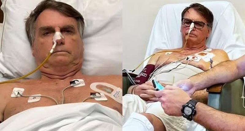 URGENTE: Bolsonaro apresenta piora clínica no início dessa noite e médicos tiveram que…ver mais