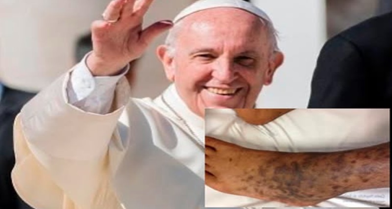 Vaticano rompe o silêncio e entrega verdadeiro motivo da causa da morte do papa Francisco foi o…Ver Mais