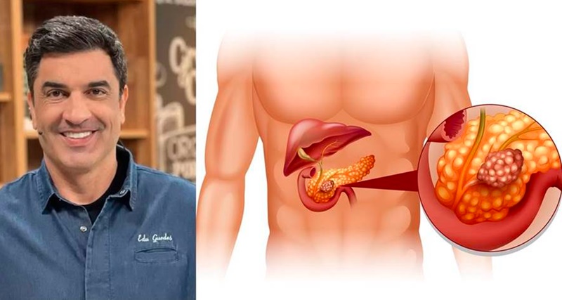 Esses são os sinais de câncer que ACOMETEL o querido apresentador Edu Guedes, inf… Ver mais