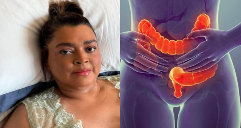 Câncer de Preta Gil era o de intestino; saiba como identificar a doença. “Fezes…Ver mais